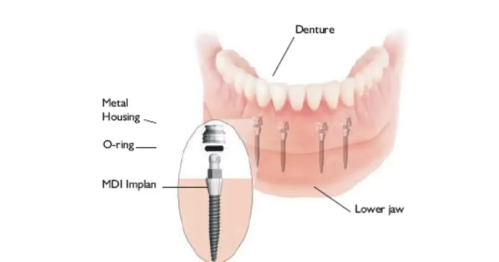 Lifestyle Factors and Bone Health