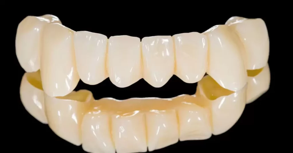 Understanding Dental Bridges