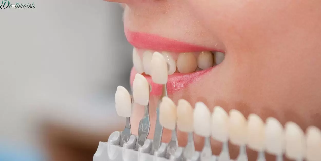 Can You Put Veneers Over Dentures?