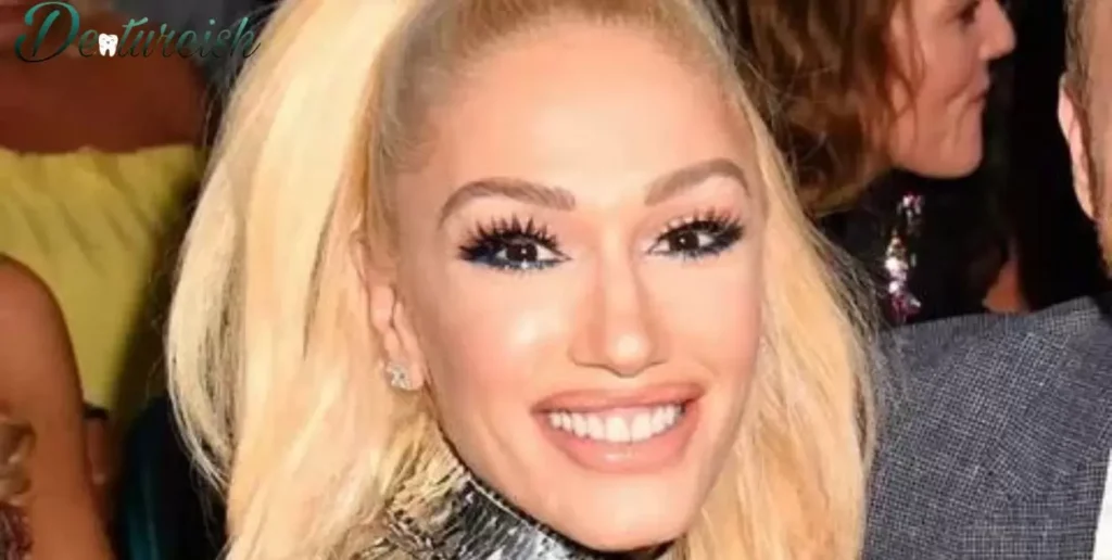 Expert Opinions on Gwen Stefani's Teeth