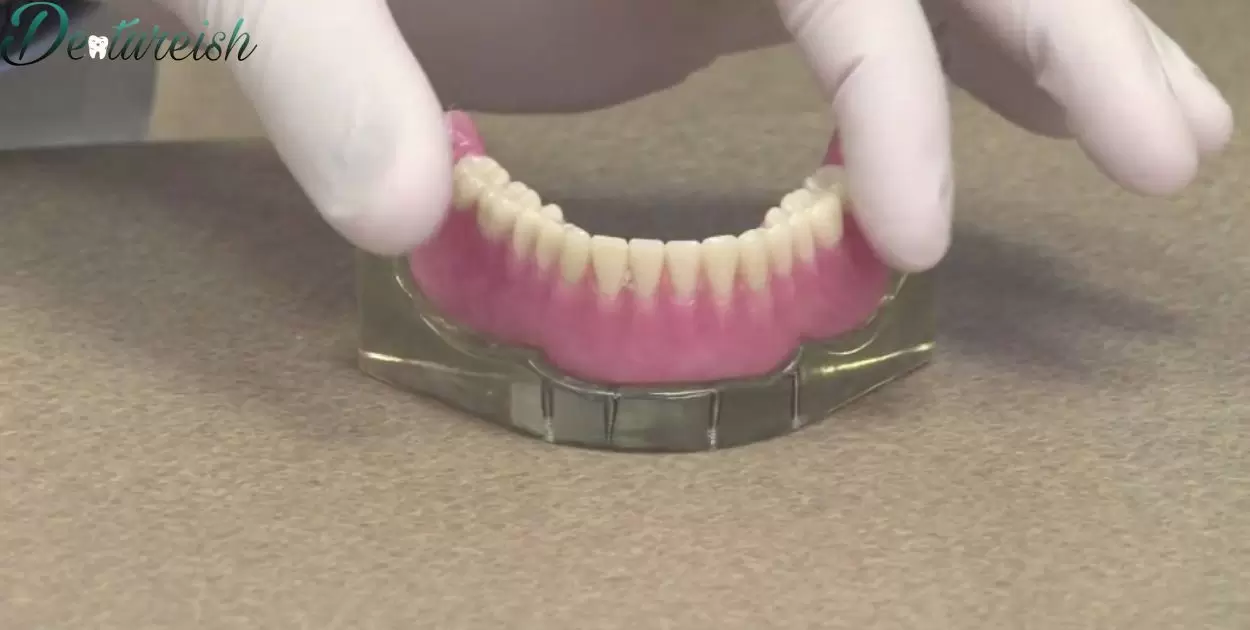 How Does A Partial Denture Stay In Place?