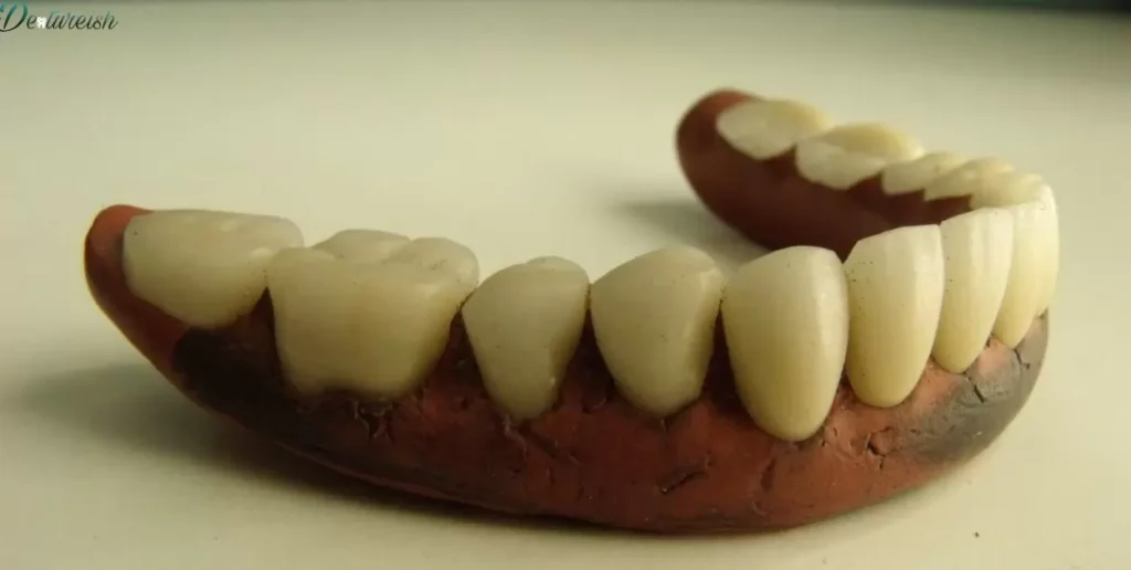 Partial Dentures For Bottom Back Teeth