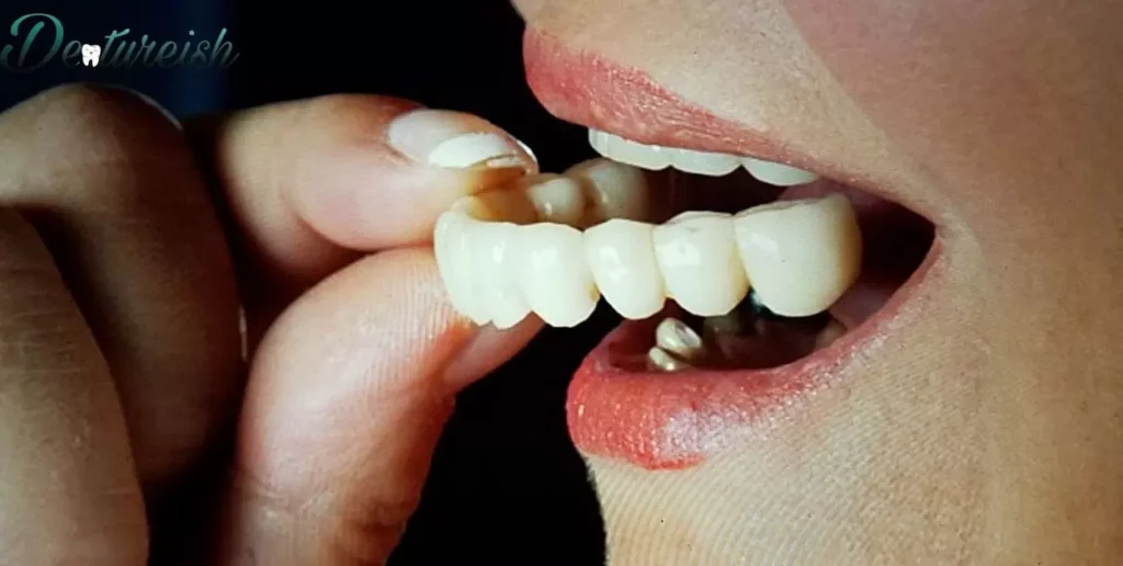 Potential Risks of Sleeping with Snap-On Dentures