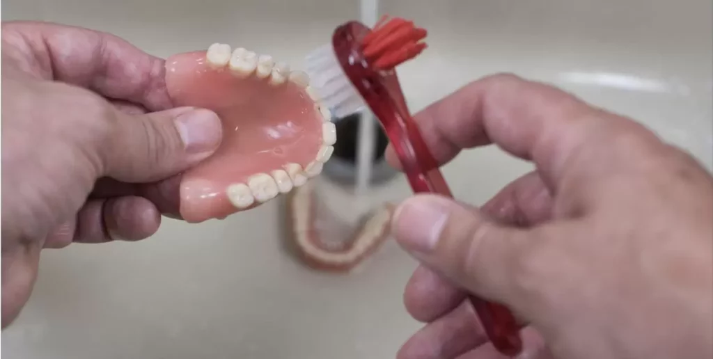 The Denture Fitting Process