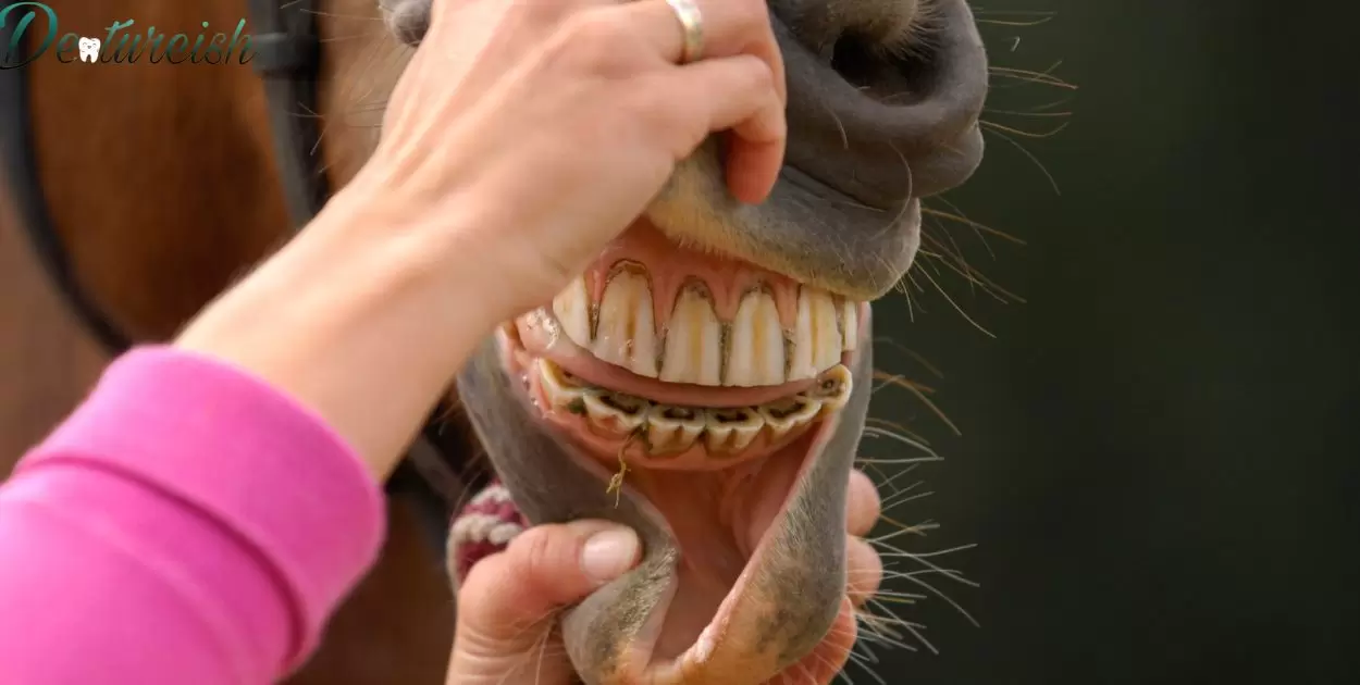 Why Do Veneers Look Like Horse Teeth?