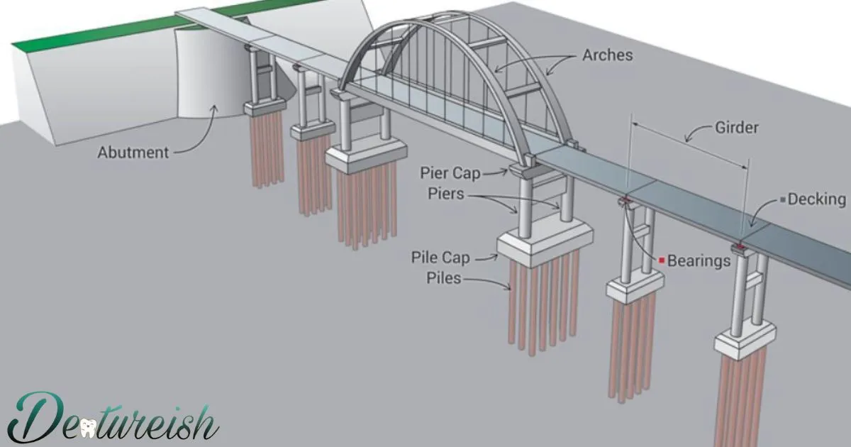 Difference Between A Partial And A Bridge