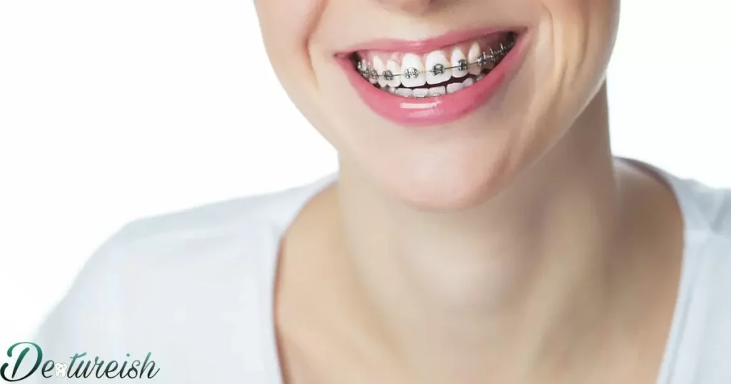 Negotiate Or Find Deals On Braces Cost In Michigan 