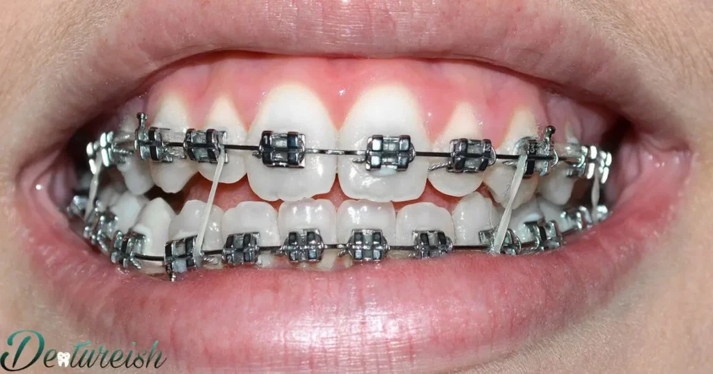 What research has been done on the lifelong effects of orthodontic realignment using braces?